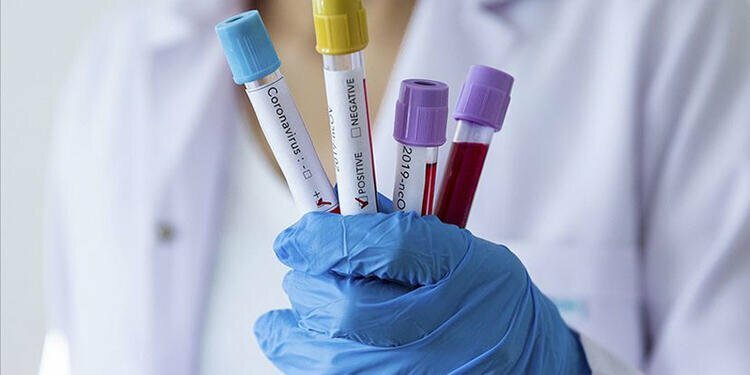 Türkiye'de corona virüs var mı? Yeni açıklama...