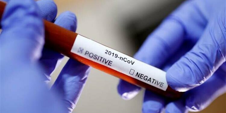 Türkiye'de okullara corona virüs tatili!