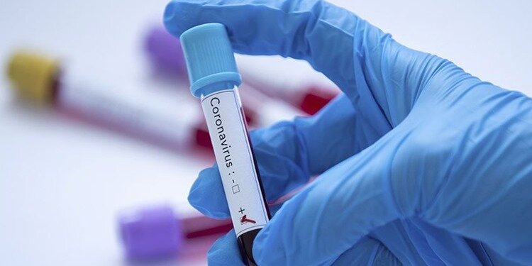 Koronavirüs'ün zayıf noktası bulundu!