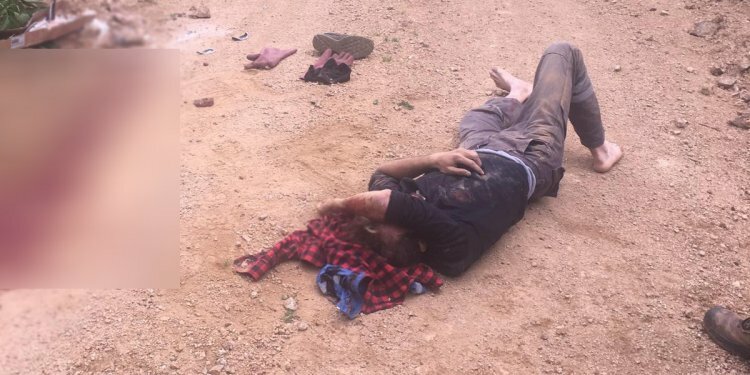 Rize'de talihsiz genç, elektrik direğinden yere çakıldı!