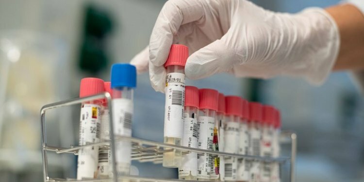 Trabzon'da esnaf koronavirüse yakalandı! Sosyal medyadan duyurdu