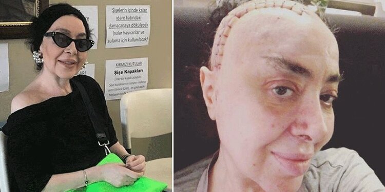 Nur Yerlitaş'ın şok eden son hali... Yorum yağdı